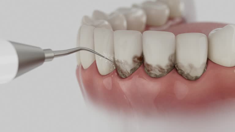 Reliable Emergency Dentist contractor in Pasadena Hills, MO by Smile Center Dentistry